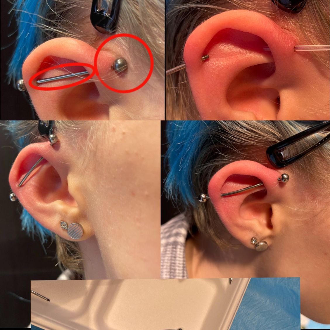 OL-INK - Piercingkorrekturen, Ohr