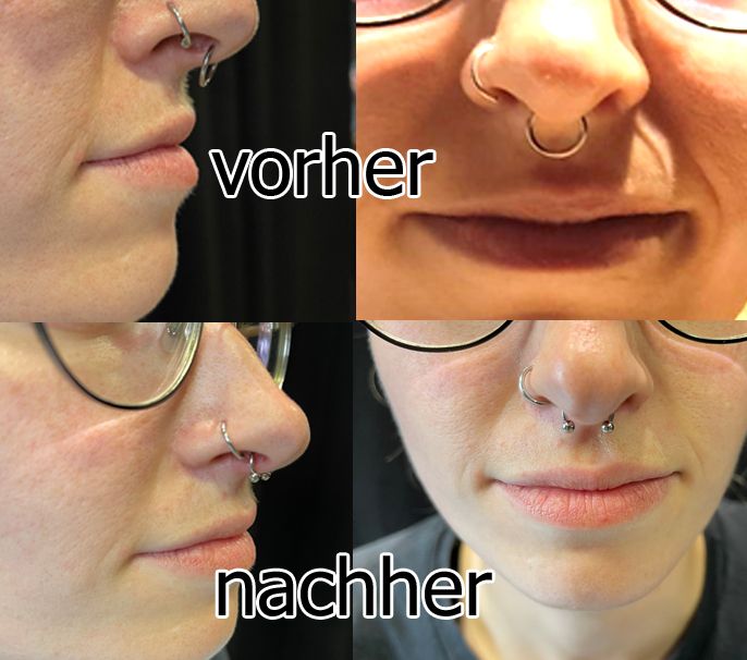 OL-INK - Piercingkorrekturen